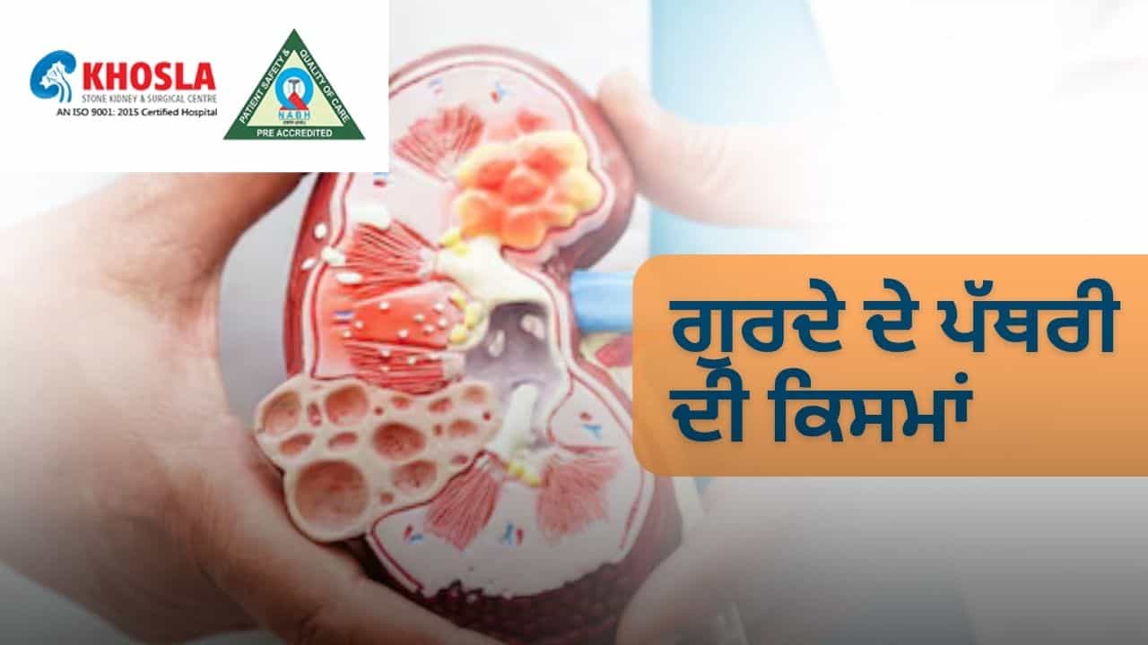 ਗੁਰਦੇ ਦੀ ਪੱਥਰੀ ਦਾ ਅੱਜ ਕਲ ਦੇ ਨੌਜਵਾਨਾਂ ਚ ਵਧਣ ਦੇ ਲੱਛਣ, ਬਚਾਓ । | Khosla Stone Kidney & Surgical Centre