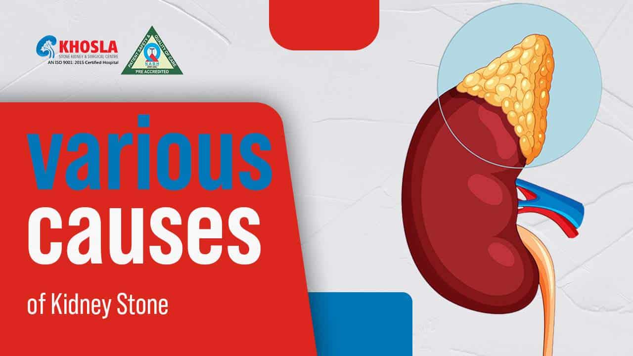 Various Causes of Kidney Stone