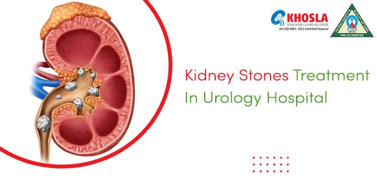 Kidney Stones: Causes, Symptoms, Management, And Its Treatment