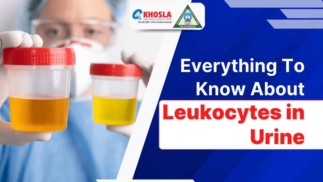 Everything To Know About Leukocytes in Urine