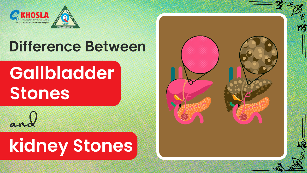 Difference Between gallbladder stones and kidney stones