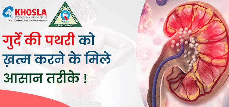घरेलू उपायों की मदद से गुर्दे की पथरी का होगा खात्मा !