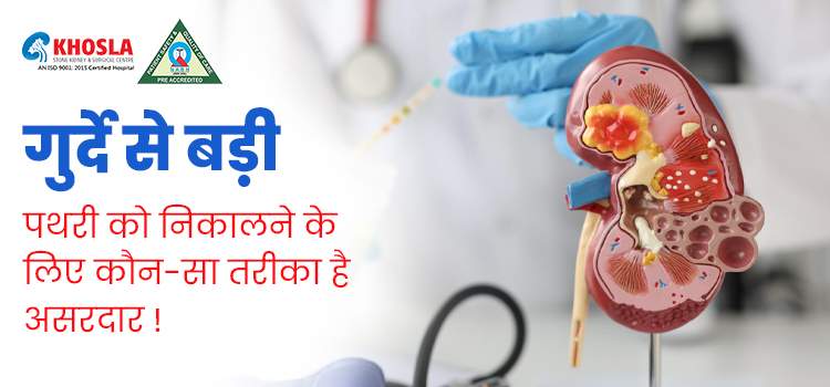 बड़ी पथरी को गलाकर बाहर निकालने के लिए अपनाएं 5 चमत्कार उपाय !