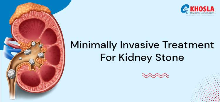  3 advanced minimally Invasive procedures for kidney stone treatment in Punjab