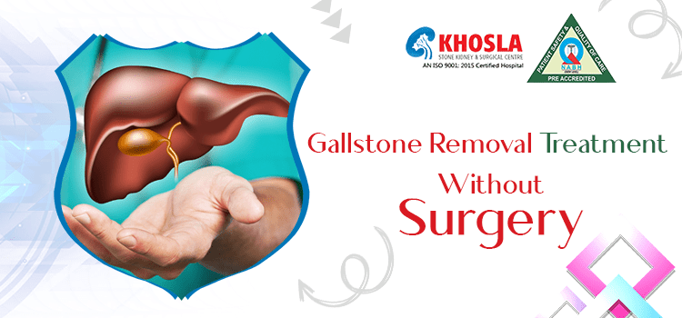 Gallstone Removal Treatment Without Surgery