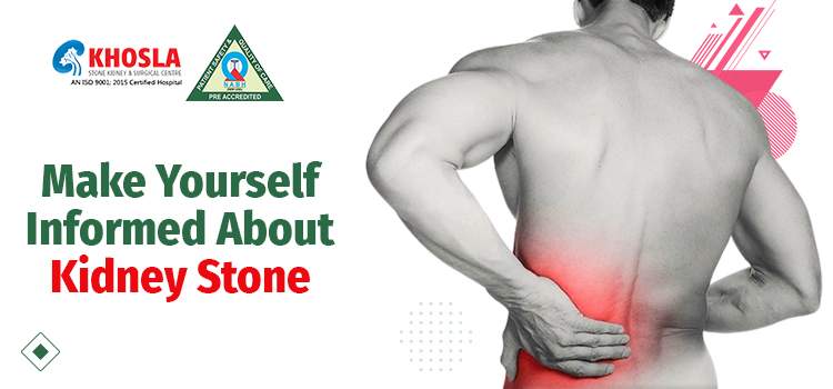 Make Yourself Informed About Kidney Stone