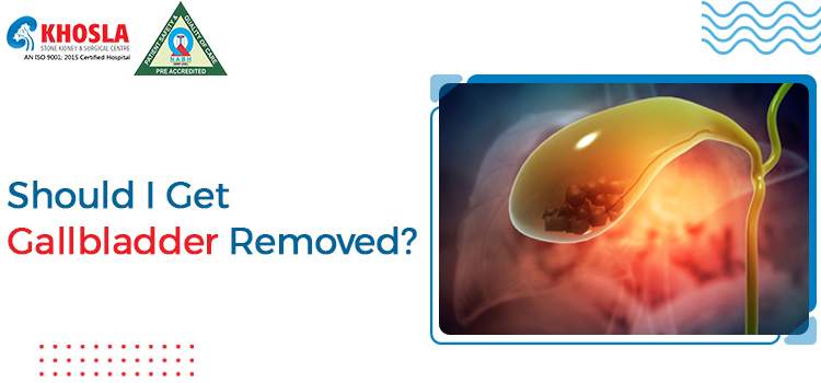 Doctor guide on, ‘Is gallbladder stone removal the only option that I have?’
