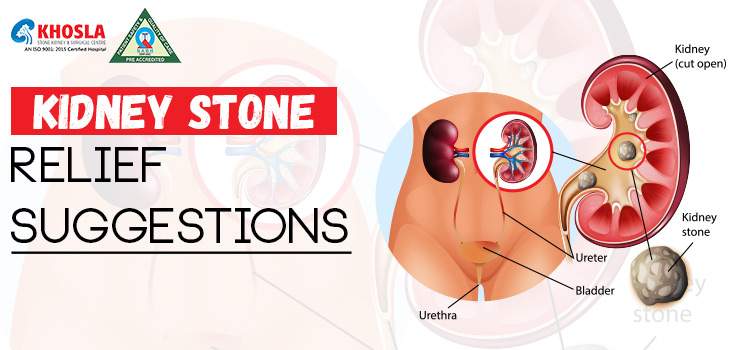 Kidney stone relief suggestions