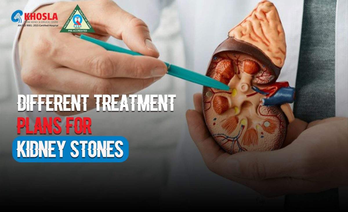 Different treatment plans for kidney stones