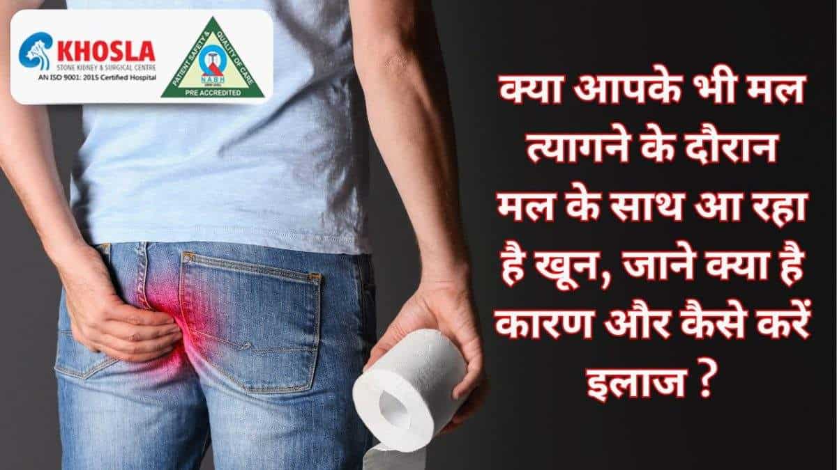 क्या आपके भी मल त्यागने के दौरान मल के साथ आ रहा है खून, जाने क्या है कारण और कैसे करें इलाज ?