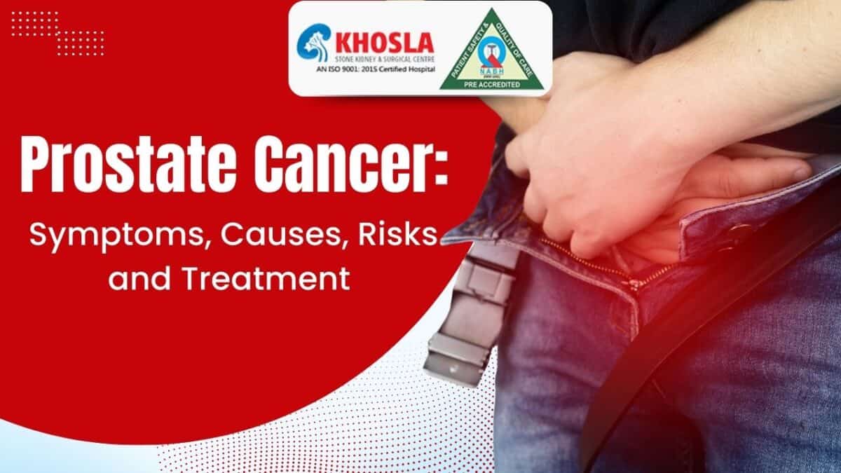 Prostate Cancer: Causes, Risks, Symptoms, and Effective Treatment Approaches