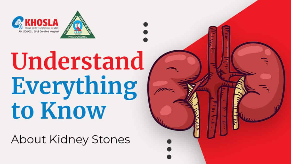 Complete Guide to Kidney Stones: Understanding Causes, Symptoms, and Prevention