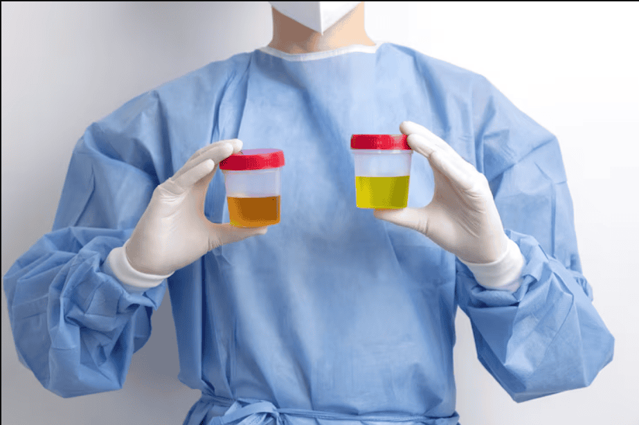Cloudy Urine: Causes, Symptoms & How to Treat It Cloudy Urine: Causes, Symptoms & How to Treat It