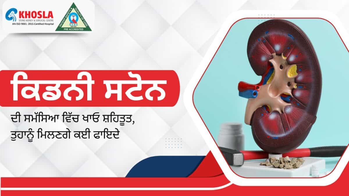 a 3D anatomical kidney model placed with stones and medicines