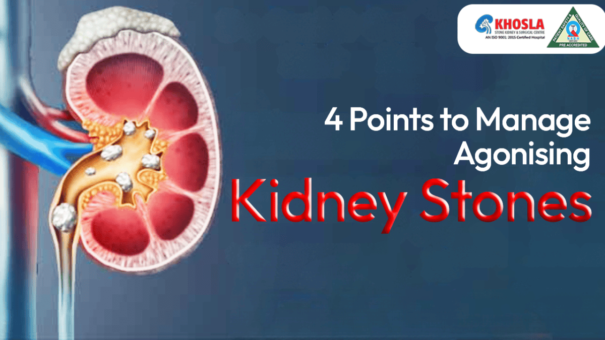 Illustration of a human kidney showing multiple kidney stones