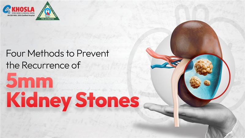 Illustration of a kidney with visible stones inside