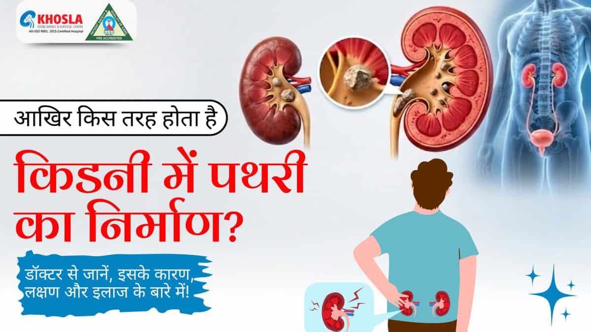 Illustration of kidney stones formation and symptoms in the human body.