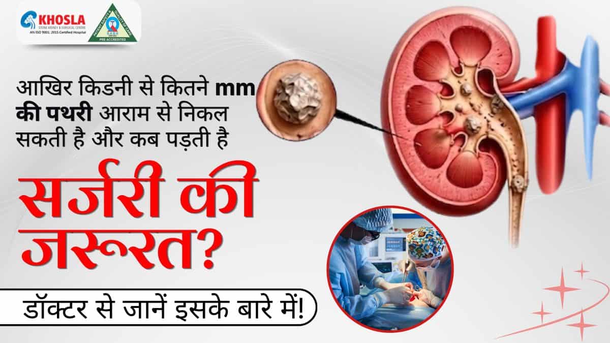 Understanding kidney stone size and when surgery is needed.