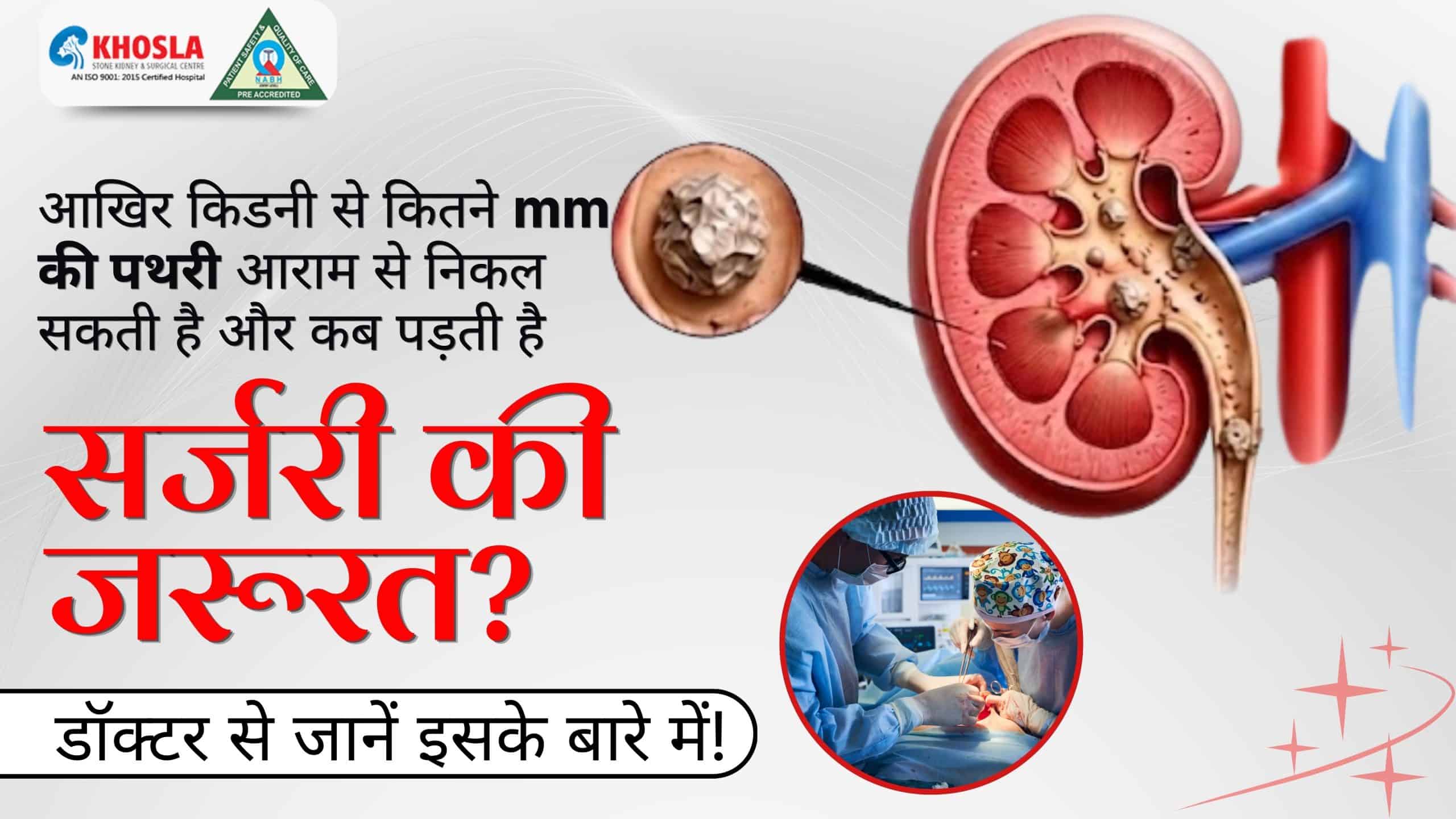  आखिर किडनी से कितने mm की पथरी आराम से निकल सकती है और कब पड़ती है सर्जरी की जरूरत? डॉक्टर से जानें इसके बारे में!