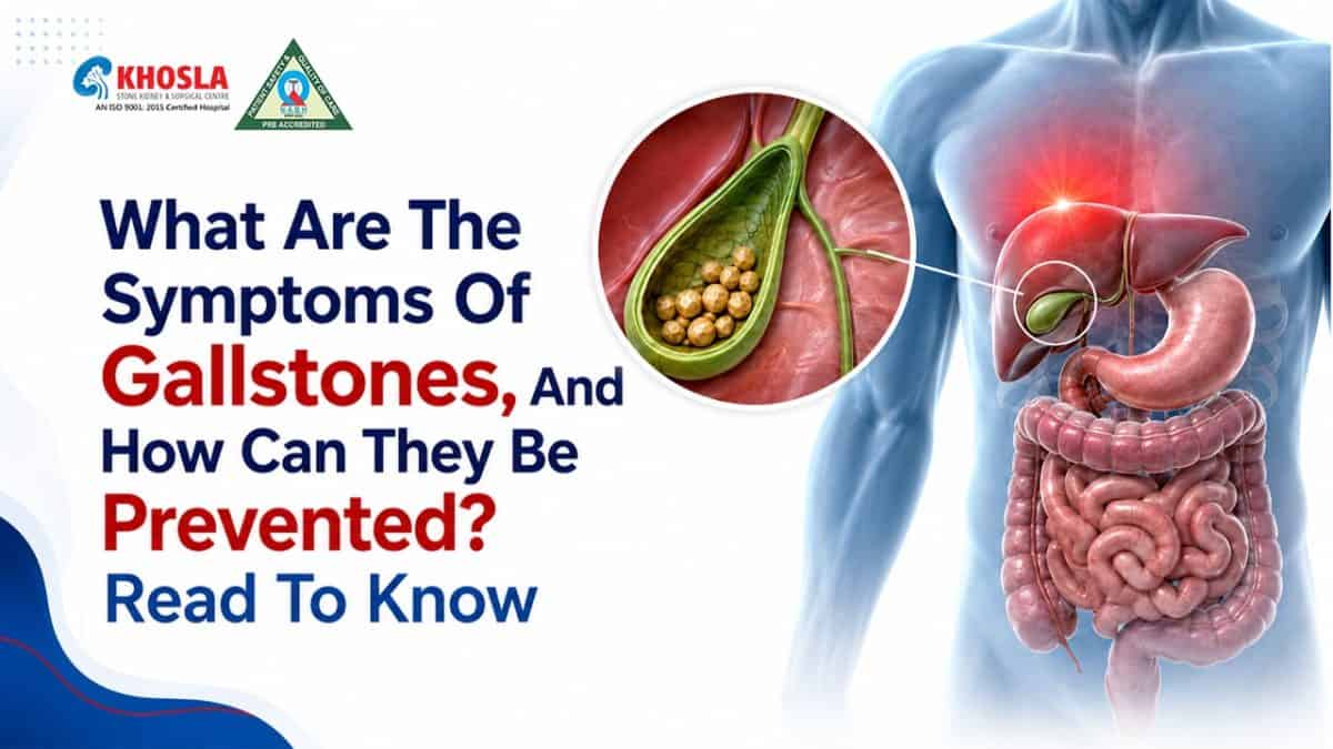 Illustration of gallstones in the gallbladder and digestive system.